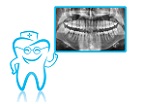 Dental Xray in Toronto